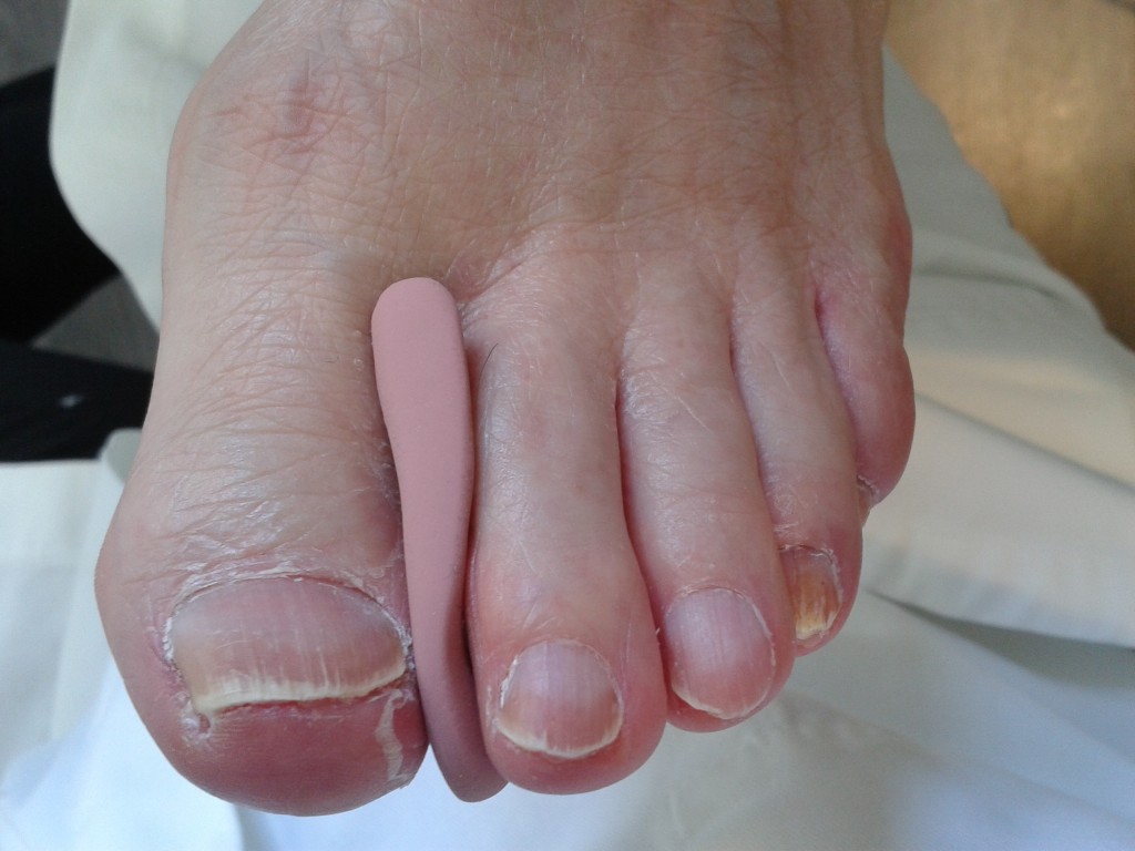 Orthoplastie Romain VAYER Pédicure Podologue Pédicure Podologue à